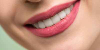 Top Teeth Whitening Products To Try
